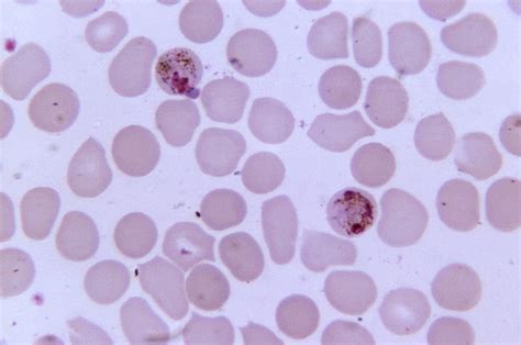 Free Picture Micrograph Two Plasmodium Malariae Schizonts