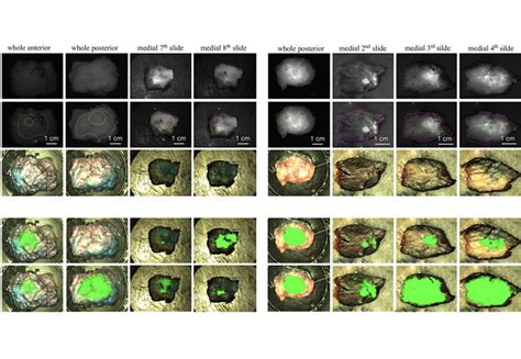 A Novel Study On Tumour Identification During Fluorescence Guided