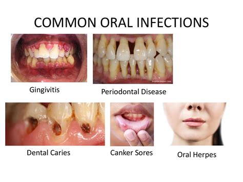 What Is Infection Online Presentation