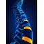 Tips To Help Manage Spinal Stenosis  Minnesota Spine Institute