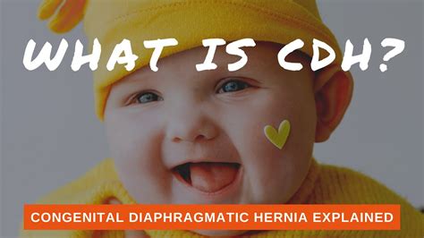 What Is Cdh Congenital Diaphragmatic Hernia Explained Youtube