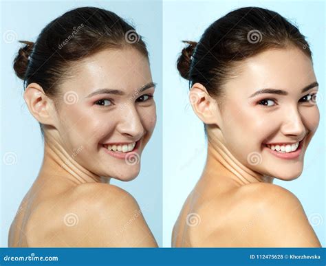 Retouch Face Of Beautiful Young Woman Before And After Retouch Stock