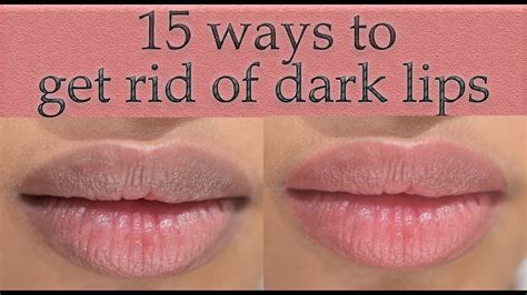 How To Lighten Dark Lips Permanently Youtube
