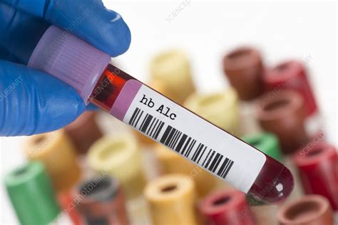 Haemoglobin A1c Blood Test Tube Stock Image F0359209 Science
