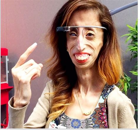 Meet 25 Year Old Lizzie Velasquez Who Was Once Taggedworlds Ugliest
