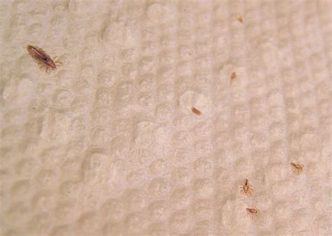 17 Best images about Lice on Pinterest | Drug store ...
