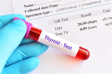 Understanding Thyroid Test Price Health E