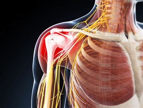 Pulsed Radiofrequency Of Axillary Suprascapular Nerves May Be