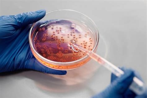 Otkriven Novi Soj Crijevnih Bakterija Koje Bi Mogle Otvoriti Put