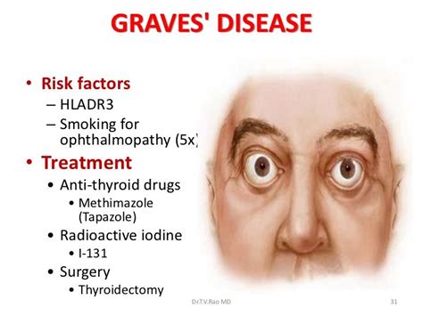 Graves Disease Click Image For More Details Graves Disease