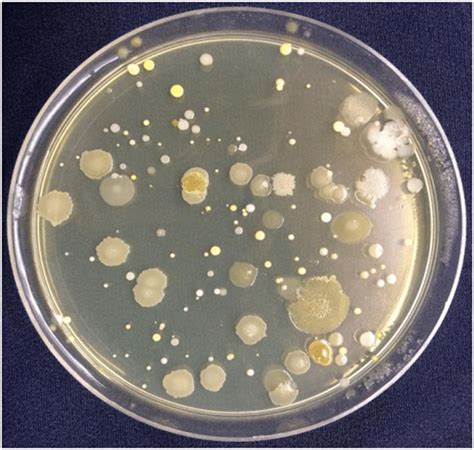 Positive Control Group Showing Bacterial Colonies Incubated From The
