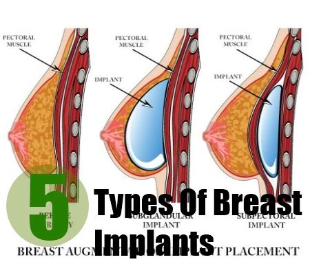 According to bra company thirdlove, you probably have one of nine types of breasts. CRAZY COOL GROOVY!!!: BRALESS THURSDAY - TAKE OFF YOUR BRA ...