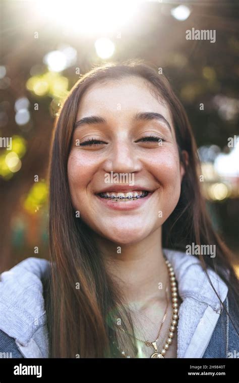Adorable Teenage Girl With Braces Smiling Cheerfully Closeup Of A