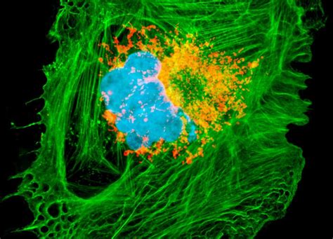 Chinese Hamster Ovary Cells Cho K Line Nikons Microscopyu