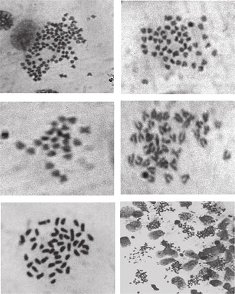 A Cromosomas De Una Célula Espermática En Estadio Leptoteno 5n