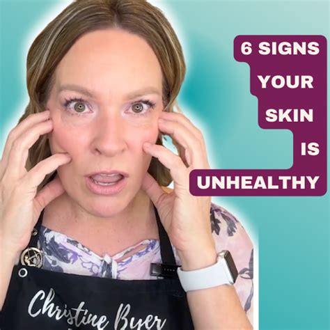 6 Signs Your Skin Is Unhealthy And How To Fix Them Christine Byer