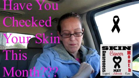 Have You Checked Your Skin This Month Your Skin