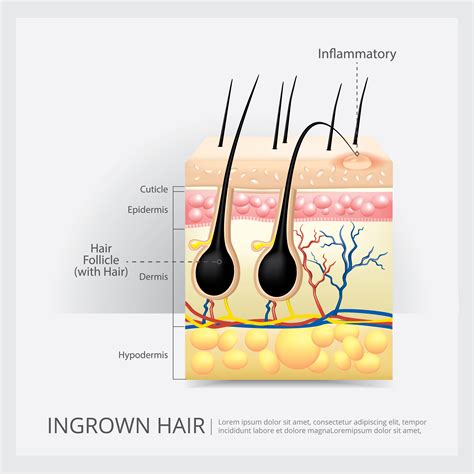 Hair Structure Anatomy