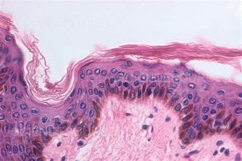 Photograph Keratinized Stratified Squamous Epithe Science Source Images