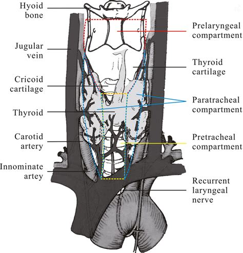 Paratracheal Lymph Node