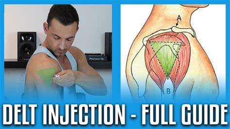 Give a slight push on the syringe to dispel a tiny amount of the vitamin b12 supplement to ensure the air is out of. How To Do A Deltoid Injection - Full Guide+Demo - YouTube