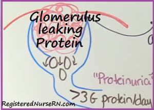 Proteinuria is a common finding in adults in primary care practice. Nephrotic Syndrome vs Glomerulonephritis NCLEX Review