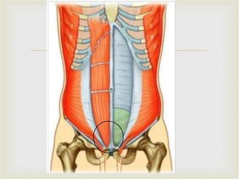 AnatomÍa De La Pared Abdominal