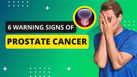 Warning Signs Of Prostate Cancer You Should Know YouTube