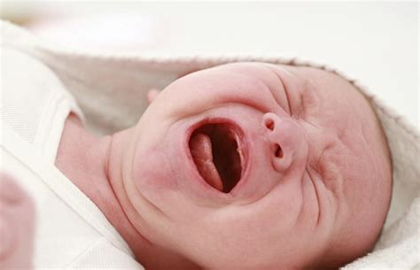 عرق سوز شدن گردن نوزاد 15 روش پیشگیری و درمان سریع مجله کوروش