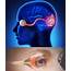 Optic Nerve Trauma  New Target Could Help Protect Vision Https