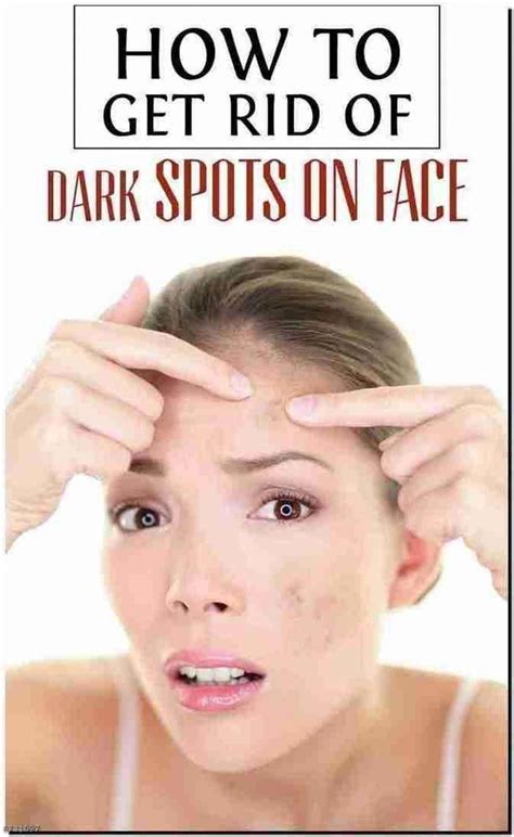 The Way To Remove Brown Spots On Experience Naturally