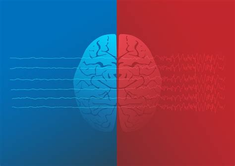 Illustration Of Human Normal Brain And Epileptic Brain Brain Waves Of
