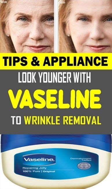 Look A Decade Younger With Vaseline Wrinkle Removal Tips And Appliance