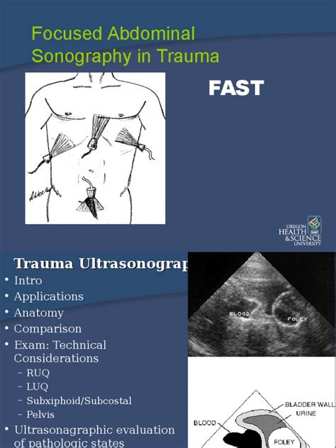 Fast Exam Major Trauma Medical Ultrasound