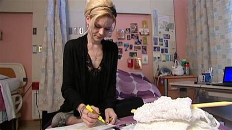 b c anorexia patient improving at alberta clinic cbc news