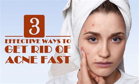 3 effective ways to get rid of acne fast by shop list medium