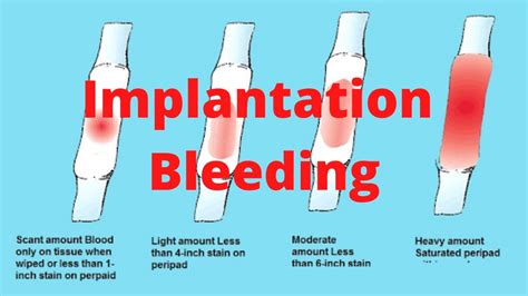 Implantation Bleeding Know Youtube