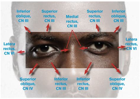 Figure Eye Movements And The Related Cranial Nerves Cns And Extraocular Muscles Acep Now