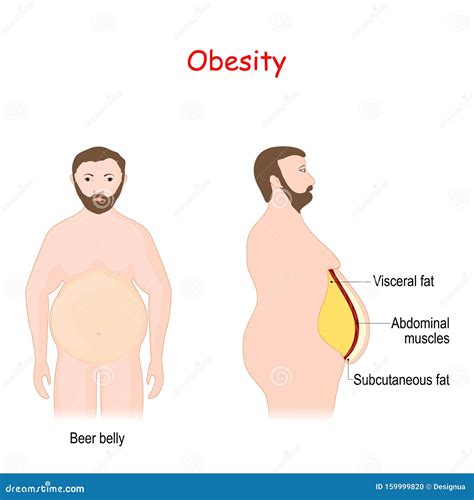 Visceral Fat And Subcutaneous Fat That Accumulate Around Your Waistline Cartoon Vector