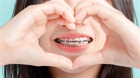 Holistic Orthodontist In Mission Viejo Provides Alternative Dental