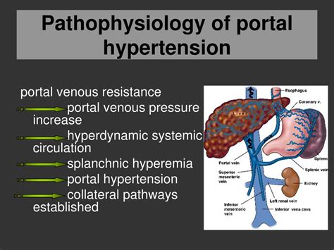Portal Hypertension Pathophysiology