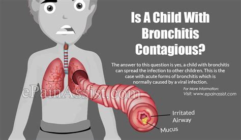 Is A Child With Bronchitis Contagious