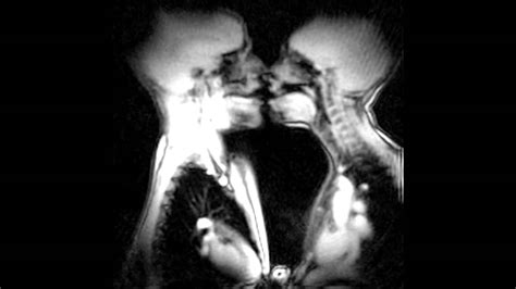 The Anatomy Of Kissing And Love In Magnetic Resonance Imaging Mri