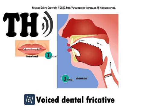 Speech Therapyca Phonetic Animation