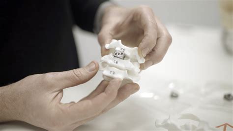 Renishaw Ntopology And Imr Partner To 3d Print Spinal Implants 3d