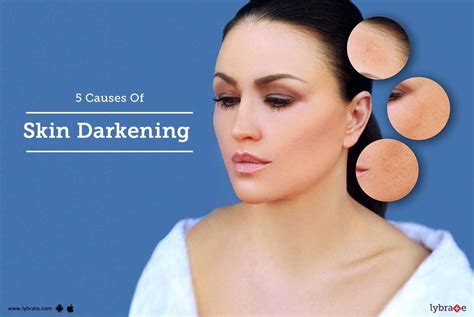 5 Causes Of Skin Darkening By Dr Nitin Jain Lybrate