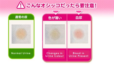 Each of these signs can vary depending on what you have your urine gets its yellow color from a pigment called urochrome. The Ultimate Guide to Your Cat's Pee - Nekoya Cat Daycare ...