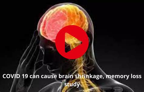 Covid 19 Can Cause Brain Shrinkage Memory Loss Study