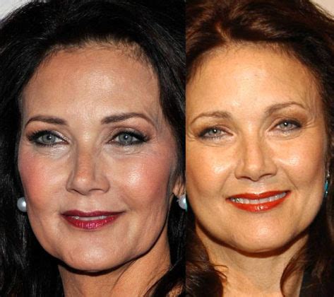 Lynda Carter Plastic Surgery With Before And After Photos