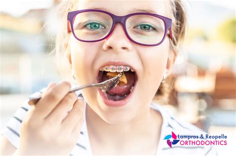 what can i eat with braces reopelle orthodontics